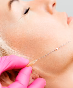 Fadenlifting (PDO)